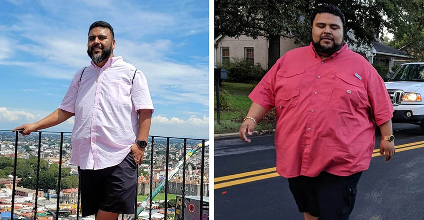 Bariatric Surgery Helps Rome Man Become More Active